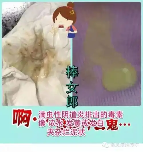 各种妇科炎症集中篇& 用棒女郎所排出的毒素(图文分解,让你清楚了解