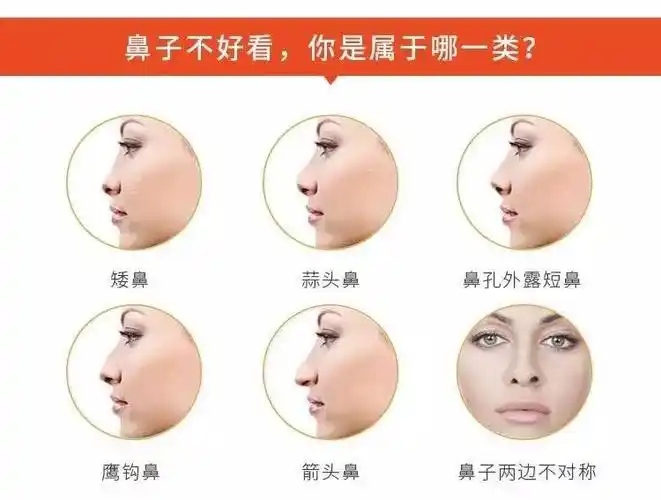 【拉斐尔国际】塌鼻子如何逆袭成为翘鼻子女神?这样做才是对的!