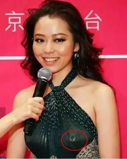 张靓颖打乳丁是怎么回事 出席活动胸部怪异(图)