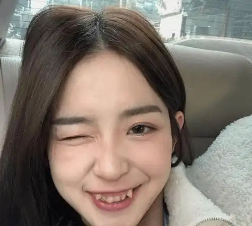 见过虎牙的,没见过这么虎牙的,你们觉得怎么样?