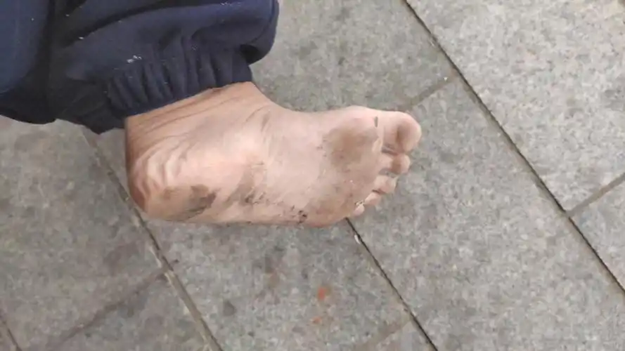 赤脚出门踩雪,感冒了也阻挡不了我赤脚生活的梦想