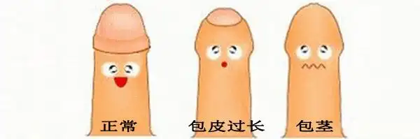 小孩包茎怎么办什么情况要做手术手术的最佳年龄是几岁