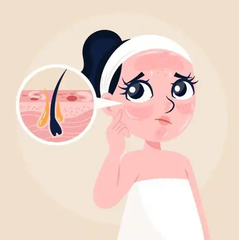 卡通油性皮肤问题矢量素材