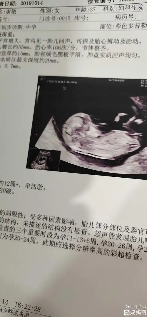 女孩是明显的三条线标志,男孩是明显的小突起亮点,好似男宝的小jj5nt