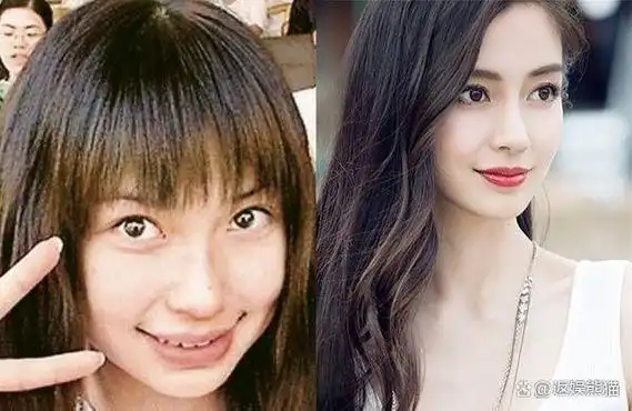 表面"倾国倾城",实则"歪瓜裂枣"的5位女明星,个个都整过容