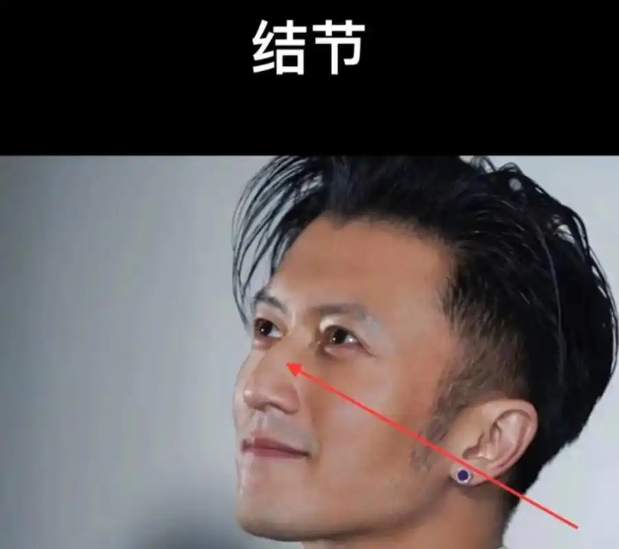 结节鼻,鼻梁骨露骨结节.无论男女,家庭或职场,这种人攻击力强 - 抖音