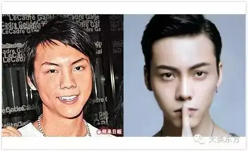 网友做出了出道至今的对比照,戏称曾经的陈伟霆像"越南人".