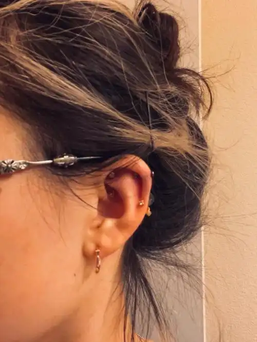 一次性集齐九尾狐rook耳蜗外耳轮