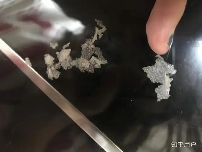 为啥我的回答被折叠昨晚拿下来的超级大的头皮屑……   显示全部