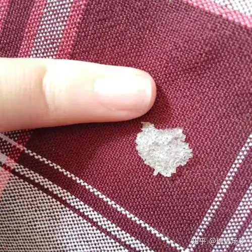 见过的最大头皮屑多大?