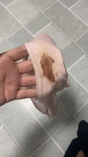 排卵期出血还是姨妈呀