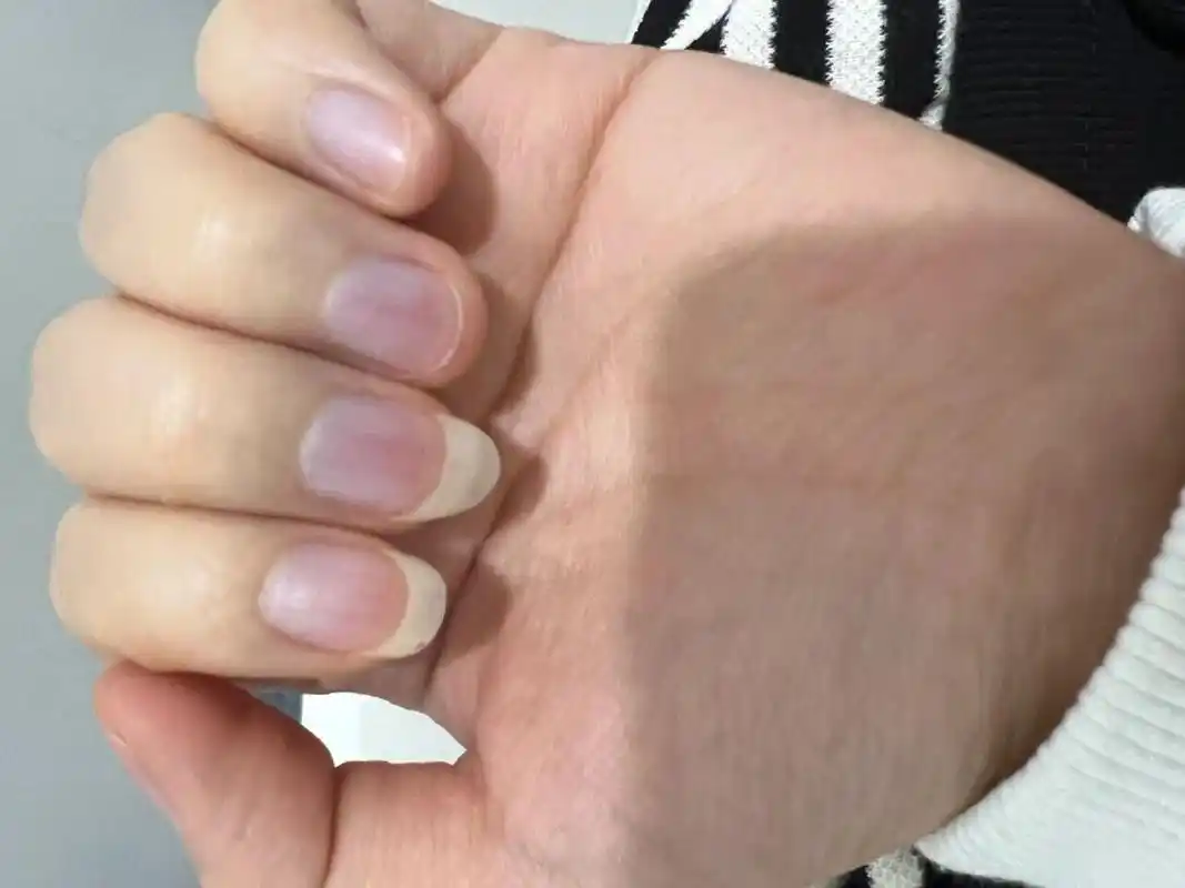 姐妹们有人知道为什么指甲盖发紫吗?肉眼看比图片还要紫一些