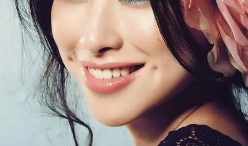 酒窝又称为:"笑窝","面靥","酒坑儿","酒靥",笑时两颊现出的小圆窝,是