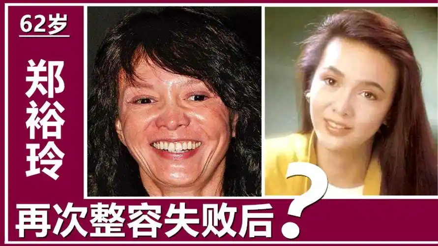 扒一扒被整容毁掉的女明星,换头又换脸,面目全非成毁容