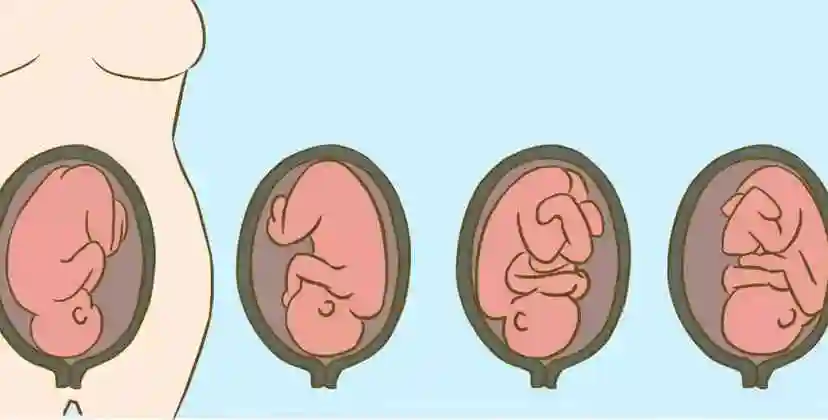 loa胎位是什么意思有胎位图展示吗