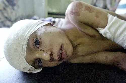 一具无头尸被移交美方 死者身份待确认(图)