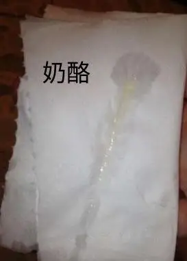 有没有和我一样被霉菌阴道炎困扰的姐妹啊