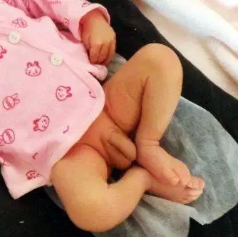 宝宝的鸡鸡特别大