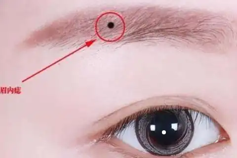 靠山痣有多厉害正财稳非富即贵身体的靠山痣在什么部位