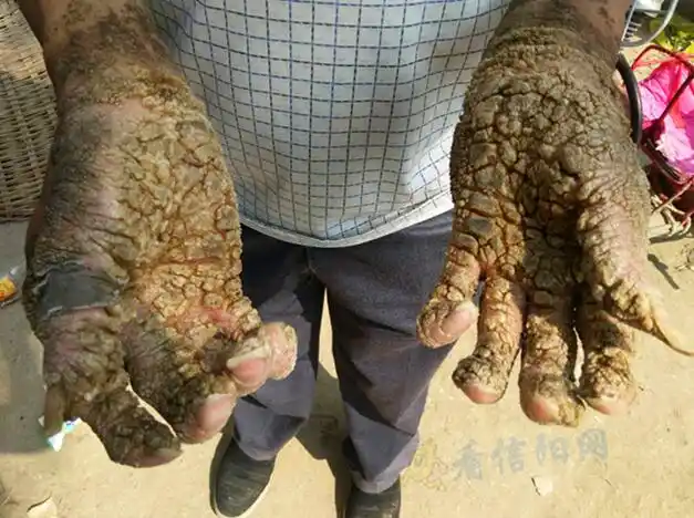 在一处破败的敞篷里小编见到了本故事中的不幸人牛某