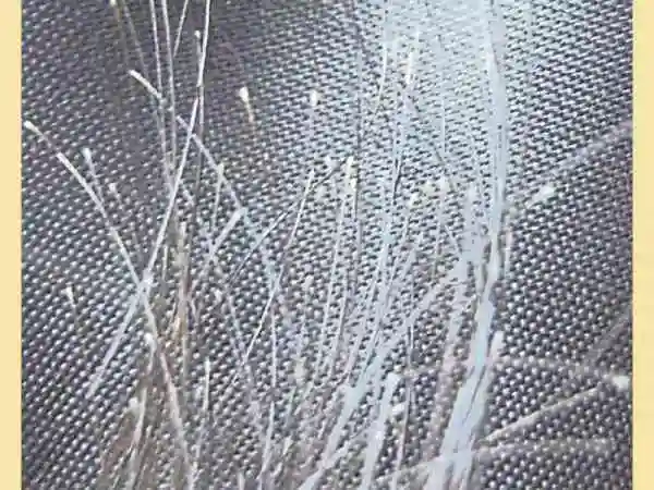 若发梢与发根粗细相同,根部还有个小白点(如图),这说明头发掉时还很