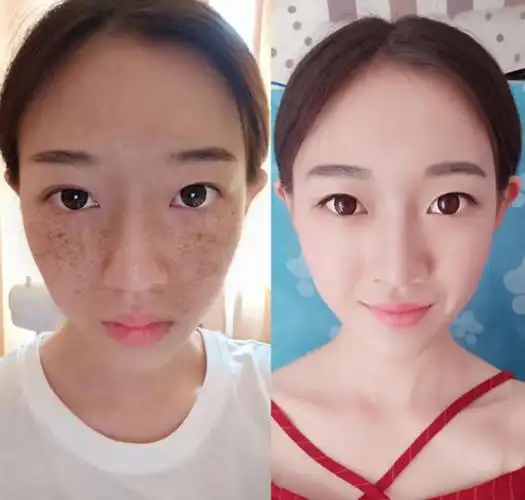 黑皮肤如何快速美白祛斑(黑皮肤怎么样变白的小妙招)2023权威解答