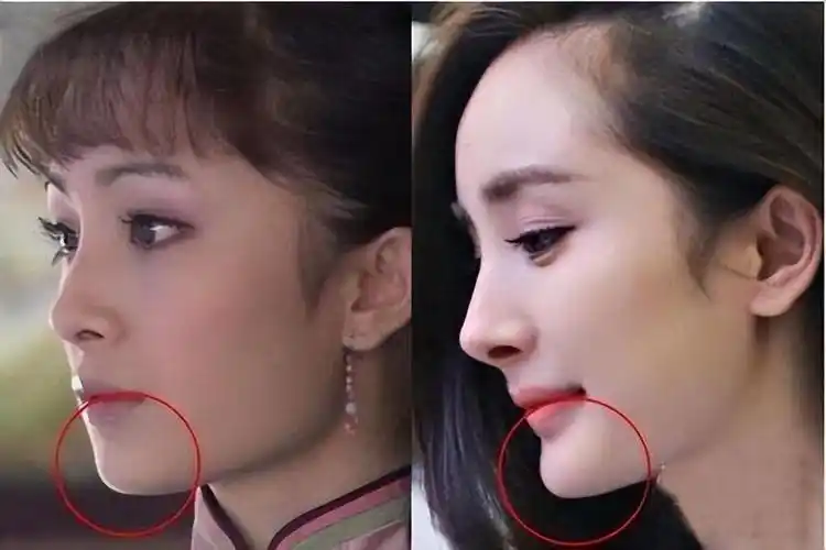 01杨幂——方脸变尖脸