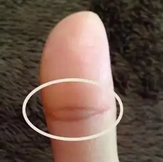 生命线短注定是短寿之人的手相