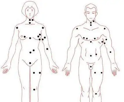 光荣吉痣,长在大腿根儿臀部以下的位置.