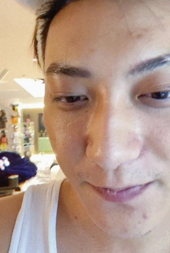 原创黄子韬直播截图被疯传,无美颜下痘痘黑头明显,这肤色是真实的吗?