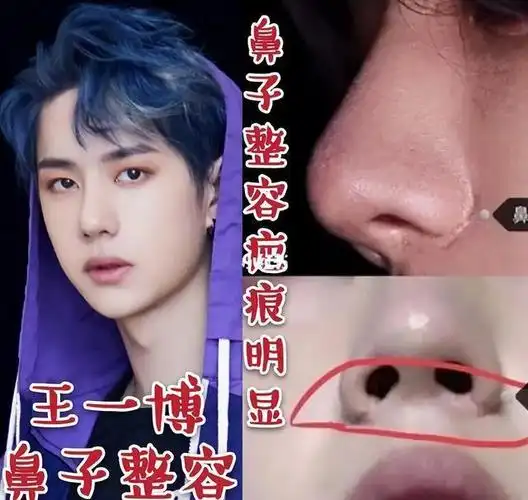 长得帅气英俊却败给一个丑鼻子这9位男星的鼻子太不懂事