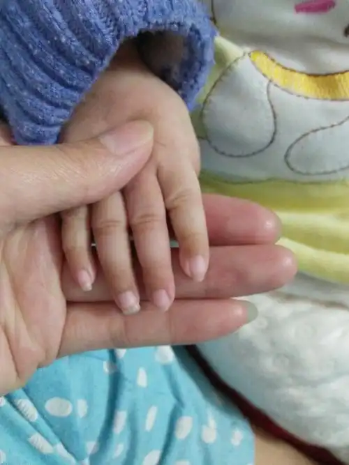 两个多月的宝宝能不能剪指甲?