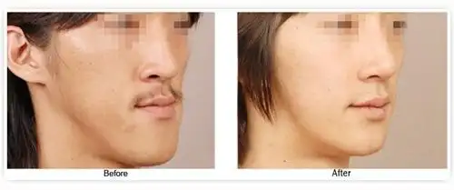 下巴过长会让人有压力,觉得好胜心很重. 返回搜