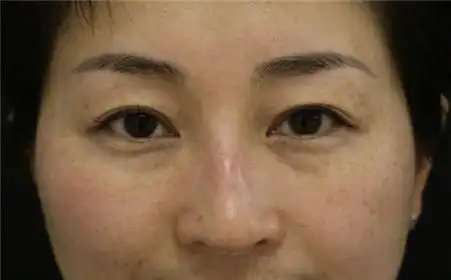 为什么韩国女性的皮肤那么好?皮肤暗沉可能与这些因素有关|色斑|内分