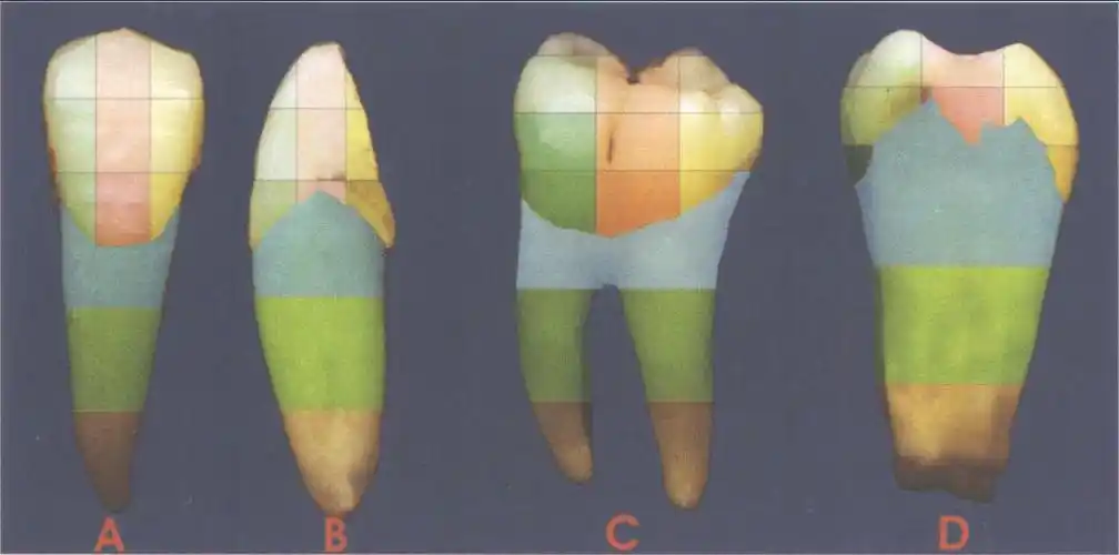 口腔颌面及颈部临床解剖学