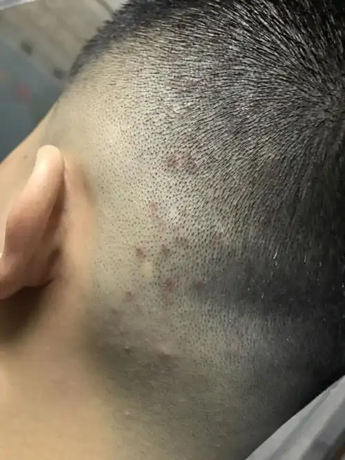 头皮上为什出现这种红点?在线等,急!