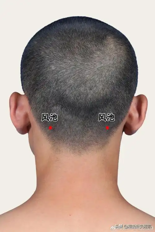 人体祛风第一大穴:风池,外风可防,内风可.