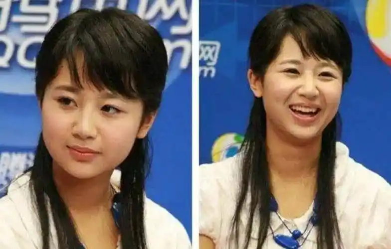 过完年,内娱明星又变样,刘诗诗歪嘴杨紫成熟,图揭颜值变迁史_杨幂