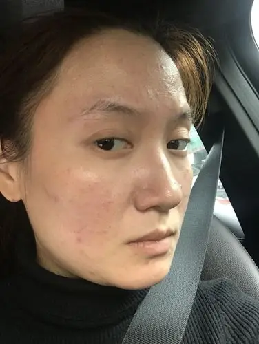 十一月24日,皮肤状态真心不好