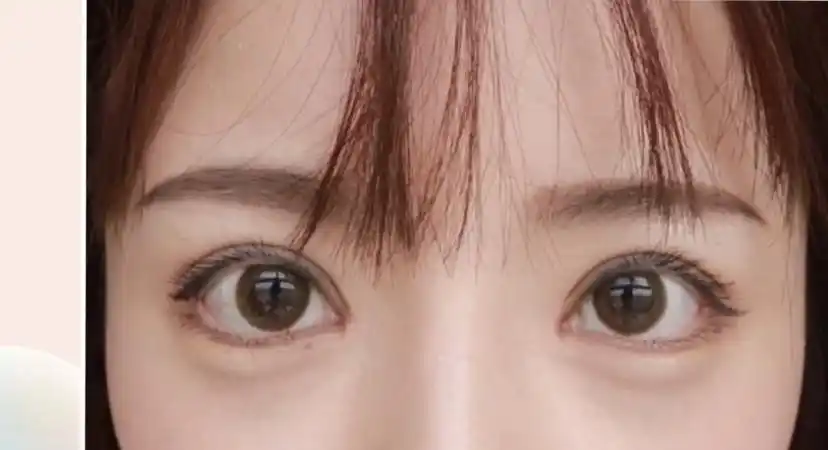 圆眼切双眼皮图片