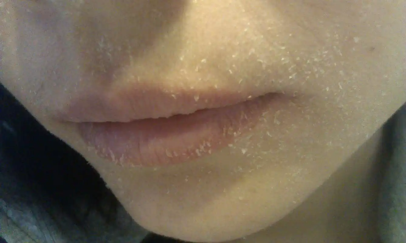 皮肤干成这样怎么办?_百度知道