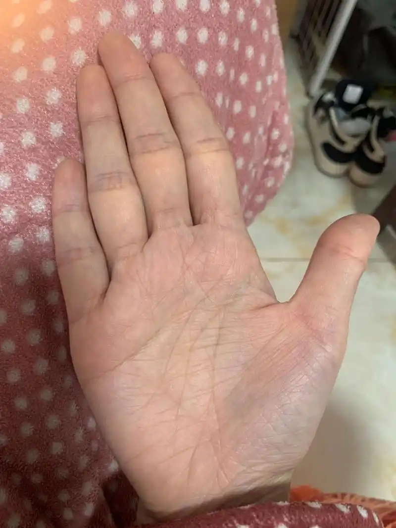 四条线的手掌纹 有比我更奇特的吗?手掌纹 关于算命 手掌纹算命