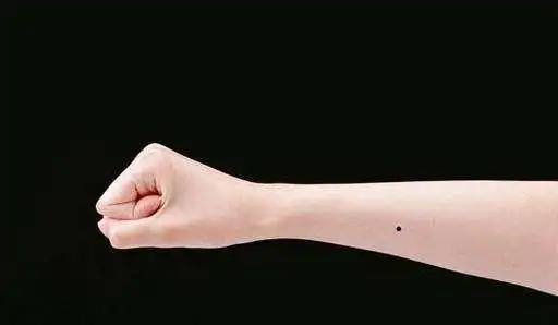 手臂上长痣代表什么手臂上长痣图解