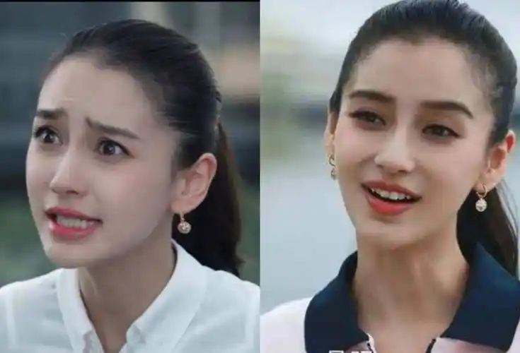 明星整容后遗症:"一刀削"脸僵挂不住肉,演戏五官乱飞,没眼看_杨幂