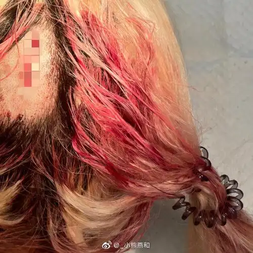 头部流血 男方疑为沙排运动员_凤凰网体育_凤凰网