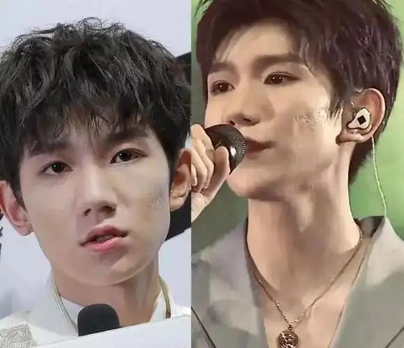 王源生日队友为其庆生,抽烟,烂脸黑料不断,仍不畏流言继续前行