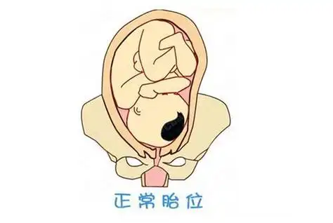 loa胎位图解 - 搜狗图片搜索