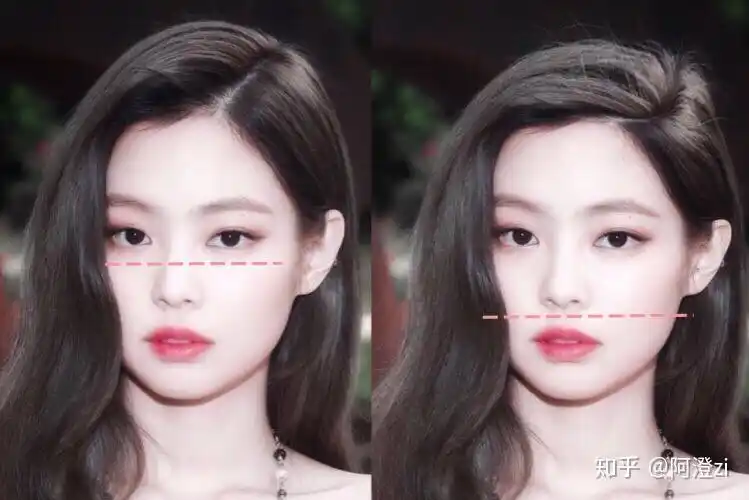 颅相审美颅顶低对颜值到底有什么影响