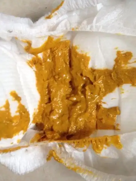 儿科医生不会告诉你的如何看懂宝宝大便