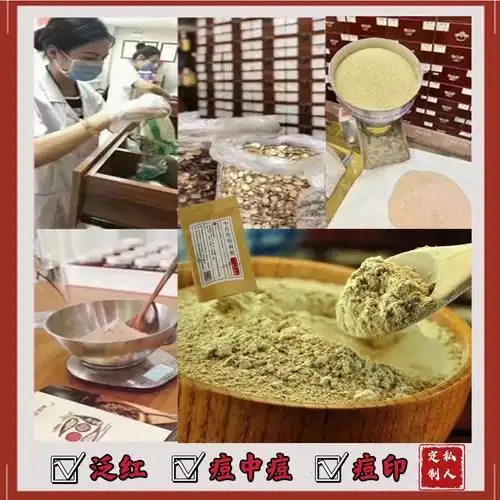 祛痘抗痘面膜粉_褪红纯中药面膜粉 控油祛粉刺抗痘退红祛痘中痘祛痘印